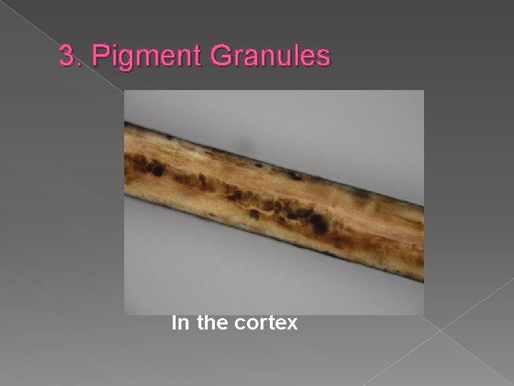 3. Pigment Granules In the cortex 