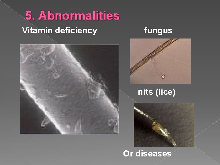 5. Abnormalities Vitamin deficiency fungus nits (lice) Or diseases 