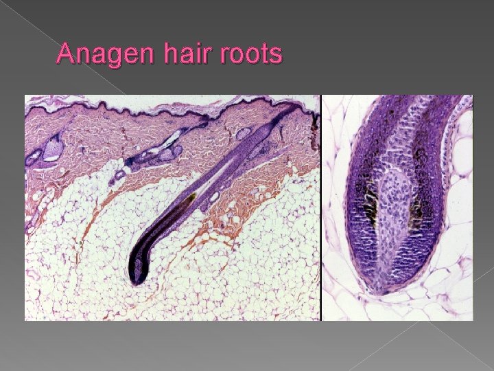 Anagen hair roots 