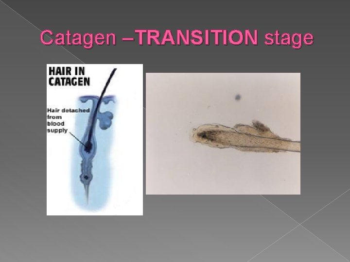 Catagen –TRANSITION stage 