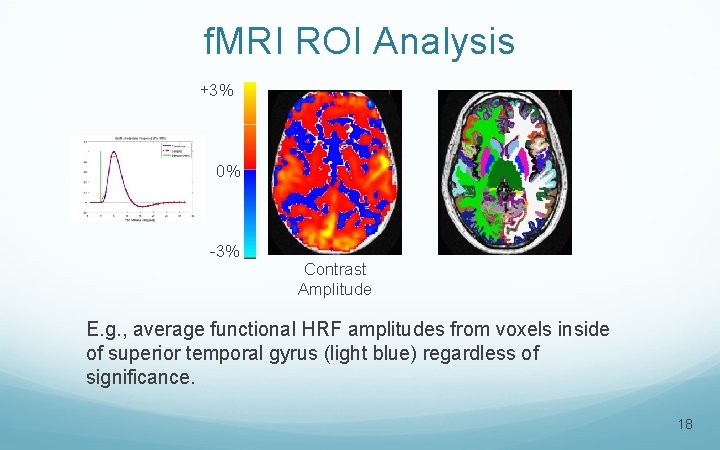 f. MRI ROI Analysis +3% 0% -3% Contrast Amplitude E. g. , average functional