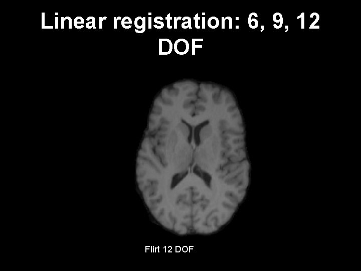 Linear registration: 6, 9, 12 DOF Flirt 6 dof 9 dof target subject Flirt