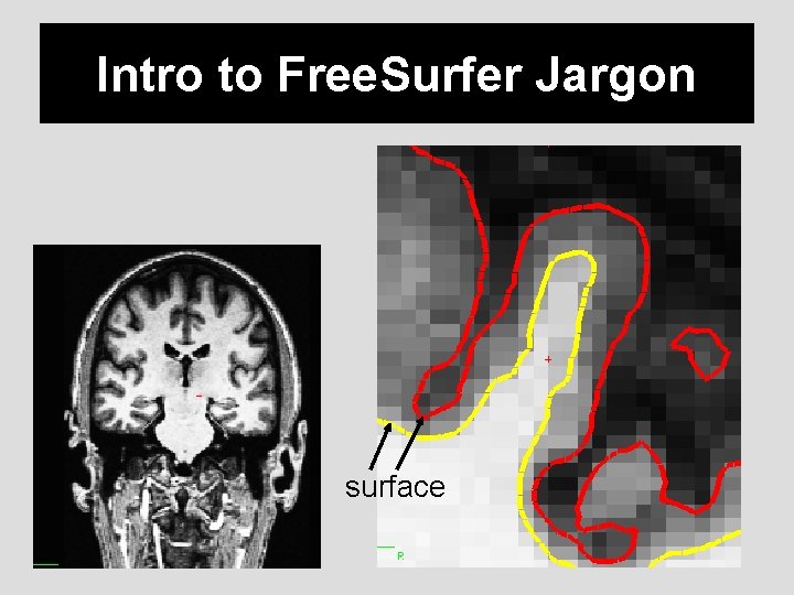 Intro to Free. Surfer Jargon surface 