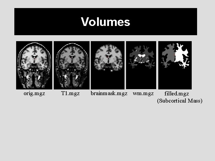 Volumes orig. mgz T 1. mgz brainmask. mgz wm. mgz filled. mgz (Subcortical Mass)