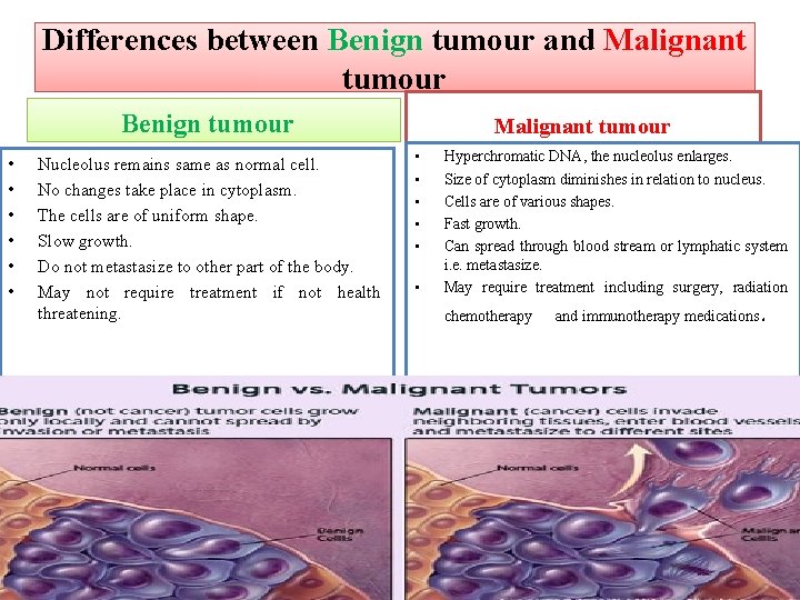 Differences between Benign tumour and Malignant tumour Benign tumour • • • Nucleolus remains