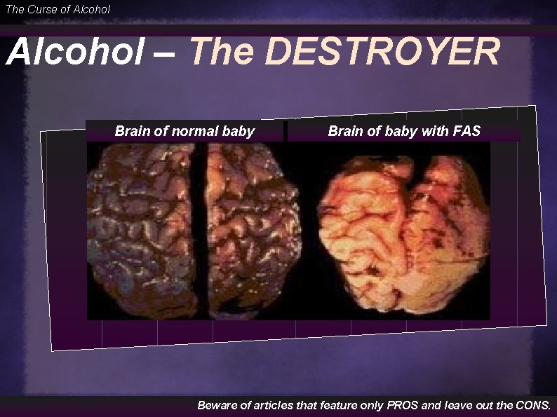 The Curse of Alcohol – The DESTROYER Brain of normal baby Brain of baby