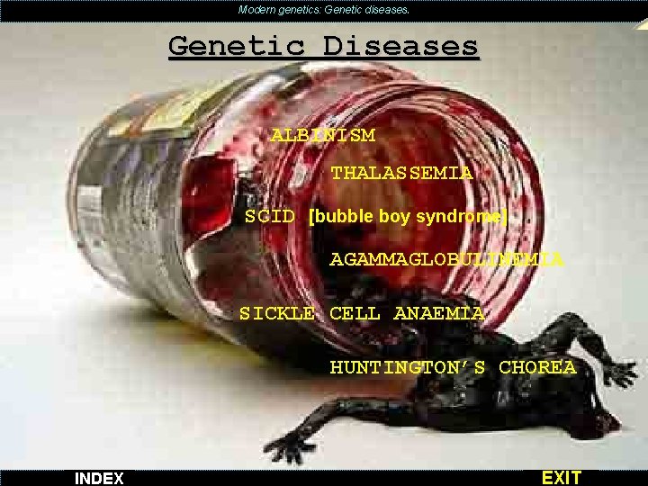 Modern genetics: Genetic diseases. Genetic Diseases ALBINISM THALASSEMIA SCID [bubble boy syndrome] AGAMMAGLOBULINEMIA SICKLE