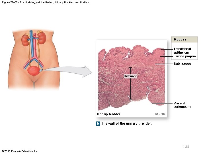 Figure 26– 19 b The Histology of the Ureter, Urinary Bladder, and Urethra. Mucosa