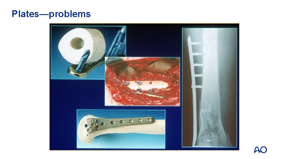 Plates—problems 
