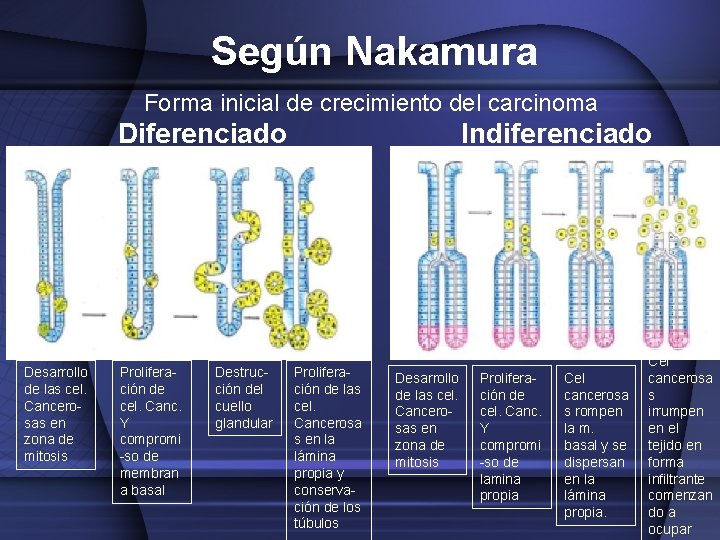 Según Nakamura Forma inicial de crecimiento del carcinoma Diferenciado Desarrollo de las cel. Cancerosas