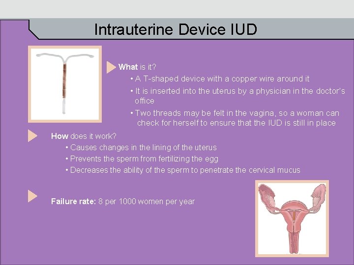 Intrauterine Device IUD What is it? • A T-shaped device with a copper wire