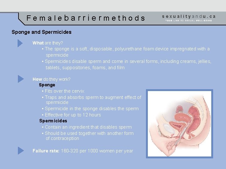 Femalebarriermethods sexualityandu. ca Sponge and Spermicides What are they? • The sponge is a