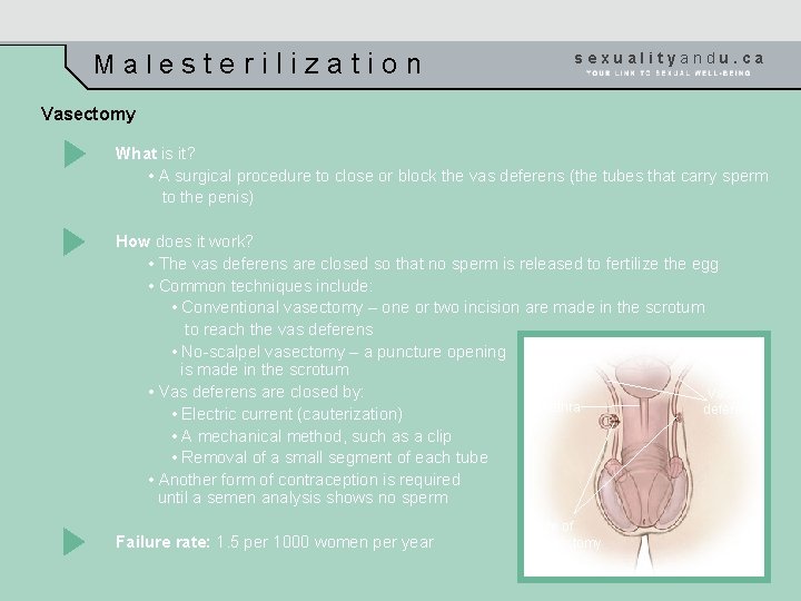 Malesterilization sexualityandu. ca Vasectomy What is it? • A surgical procedure to close or