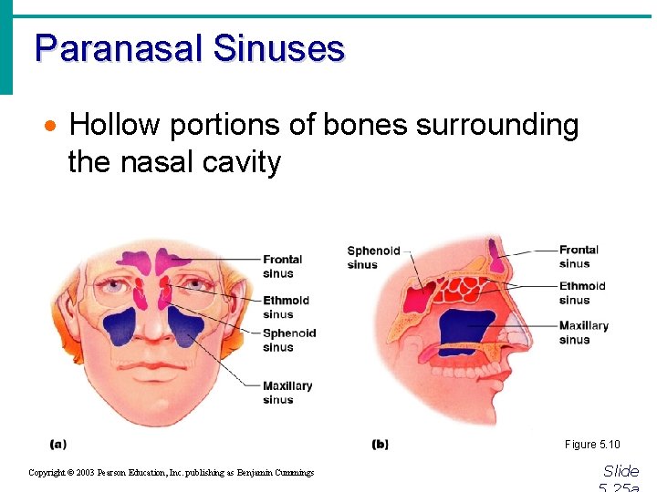 Paranasal Sinuses · Hollow portions of bones surrounding the nasal cavity Figure 5. 10