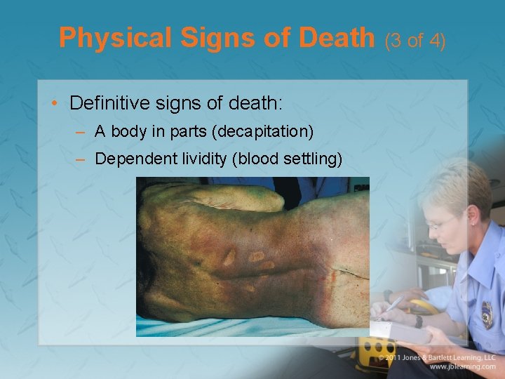 Physical Signs of Death (3 of 4) • Definitive signs of death: – A