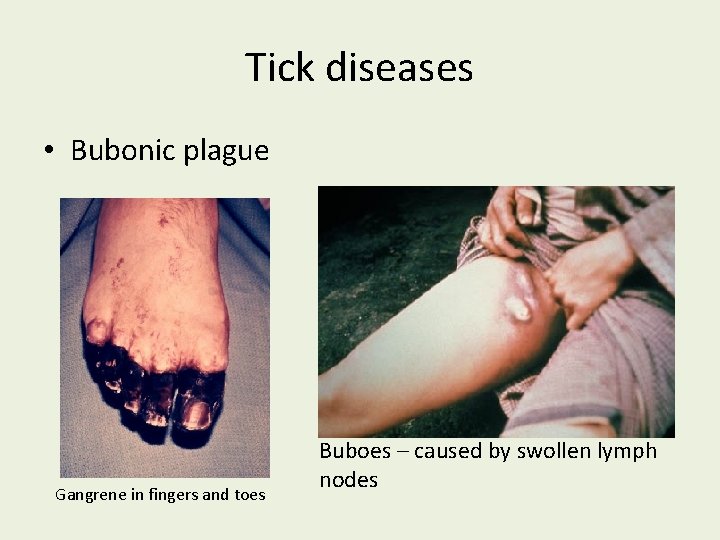 Tick diseases • Bubonic plague Gangrene in fingers and toes Buboes – caused by