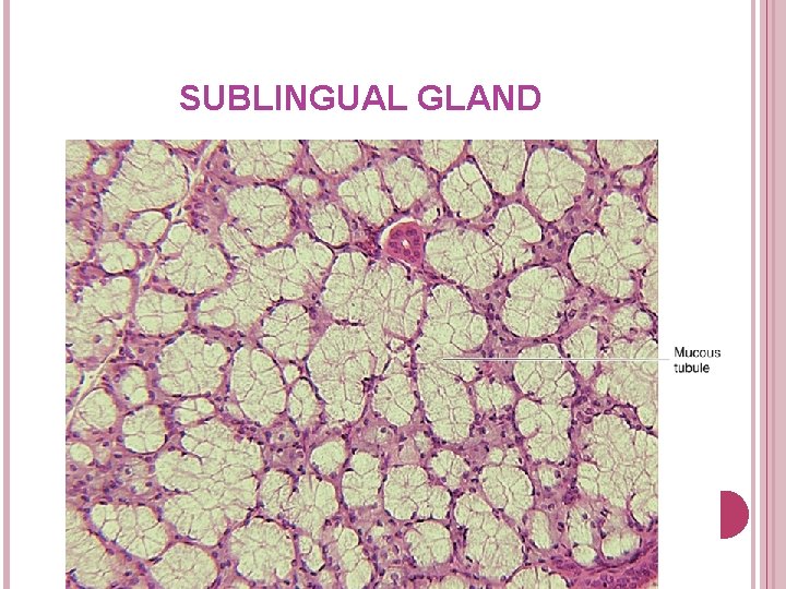 SUBLINGUAL GLAND 