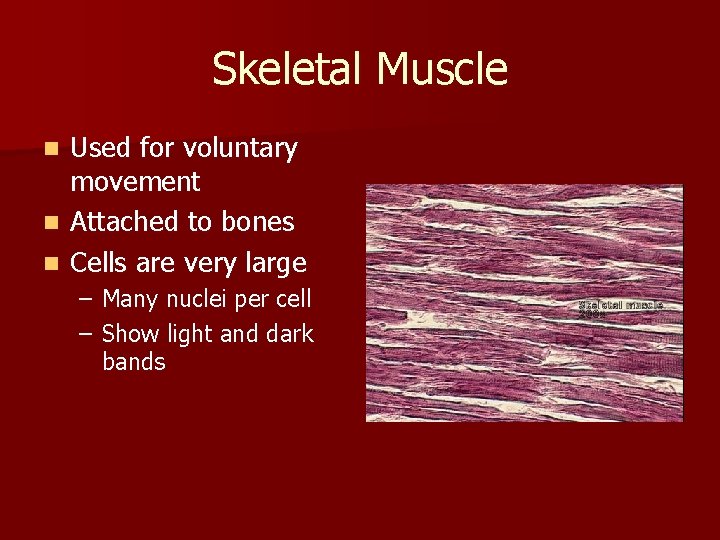 Skeletal Muscle n n n Used for voluntary movement Attached to bones Cells are