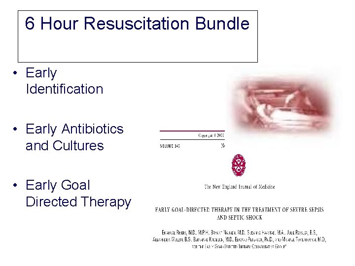 6 Hour Resuscitation Bundle • Early Identification • Early Antibiotics and Cultures • Early 6 Hour Resuscitation Bundle • Early Identification • Early Antibiotics and Cultures • Early