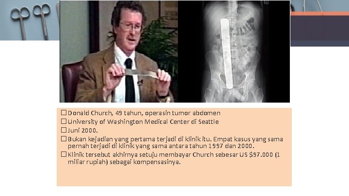 � Donald Church, 49 tahun, operasin tumor abdomen � University of Washington Medical Center