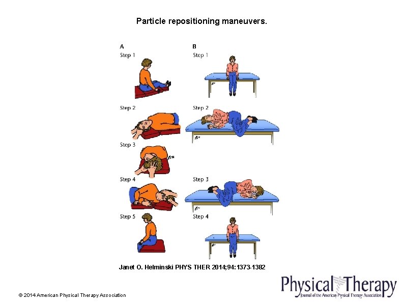 Particle repositioning maneuvers. Janet O. Helminski PHYS THER 2014; 94: 1373 -1382 © 2014