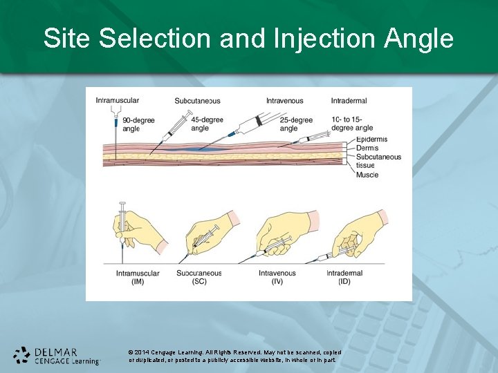 Site Selection and Injection Angle © 2014 Cengage Learning. All Rights Reserved. May not