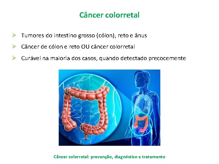 Câncer colorretal Ø Tumores do intestino grosso (cólon), reto e ânus Ø Câncer de