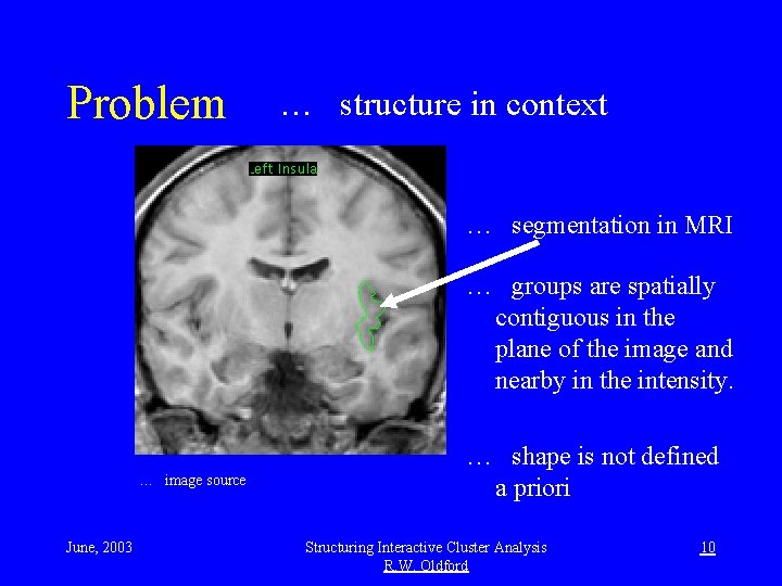 Problem … structure in context … segmentation in MRI … groups are spatially contiguous