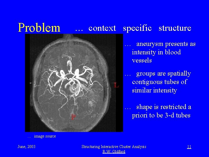 Problem … context specific structure … aneurysm presents as intensity in blood vessels …