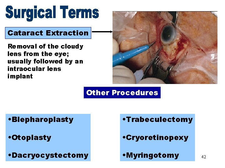 Surgical Terms Cataract Extraction Removal of the cloudy lens from the eye; usually followed