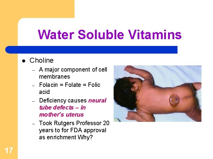 Water Soluble Vitamins l Choline – – 17 A major component of cell membranes