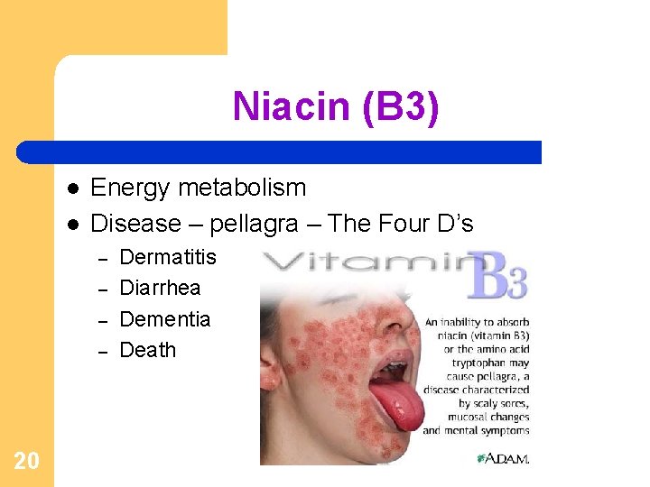 Niacin (B 3) l l Energy metabolism Disease – pellagra – The Four D’s