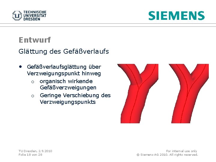 Entwurf Glättung des Gefäßverlaufs • Gefäßverlaufsglättung über Verzweigungspunkt hinweg o organisch wirkende Gefäßverzweigungen o