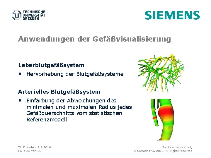 Anwendungen der Gefäßvisualisierung Leberblutgefäßsystem • Hervorhebung der Blutgefäßsysteme Arterielles Blutgefäßsystem • Einfärbung der Abweichungen