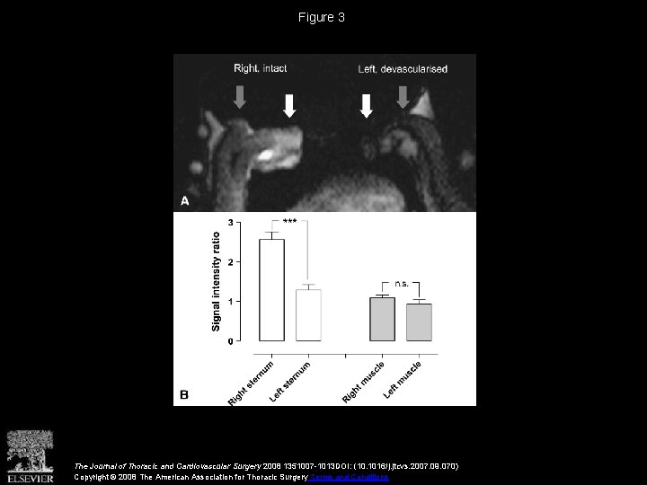 Figure 3 The Journal of Thoracic and Cardiovascular Surgery 2008 1351007 -1013 DOI: (10.