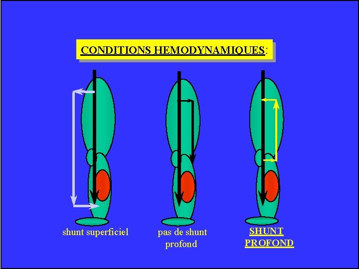 CONDITIONS HEMODYNAMIQUES: shunt superficiel pas de shunt profond SHUNT PROFOND 