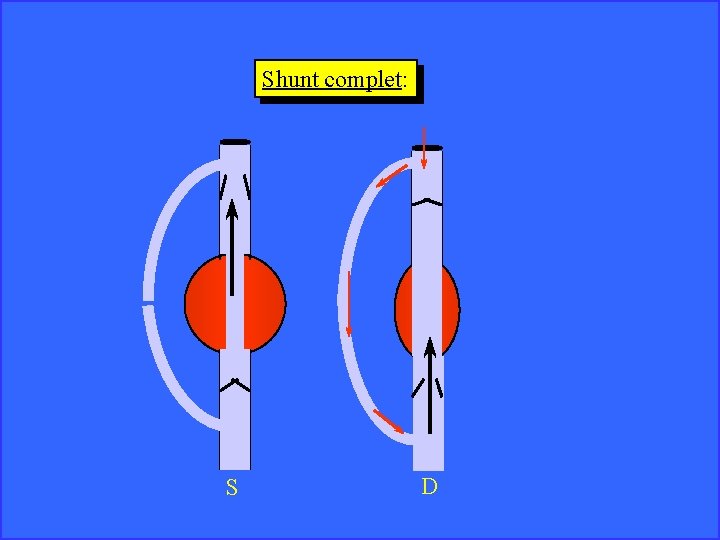 Shunt complet: S D 