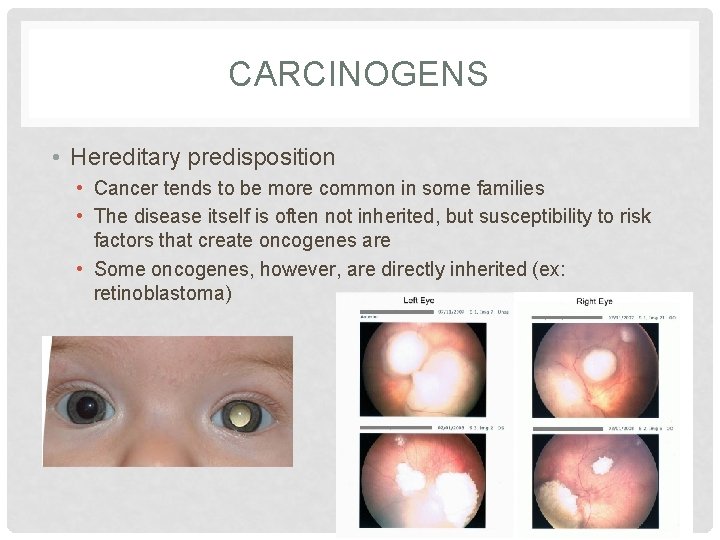 CARCINOGENS • Hereditary predisposition • Cancer tends to be more common in some families