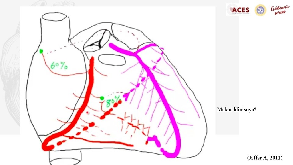 Makna klinisnya? (Jaffar A, 2011) 