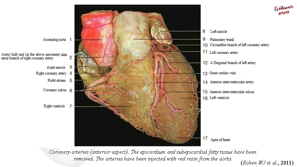 Coronary arteries (anterior aspect). The epicardium and subepicardial fatty tissue have been removed. The