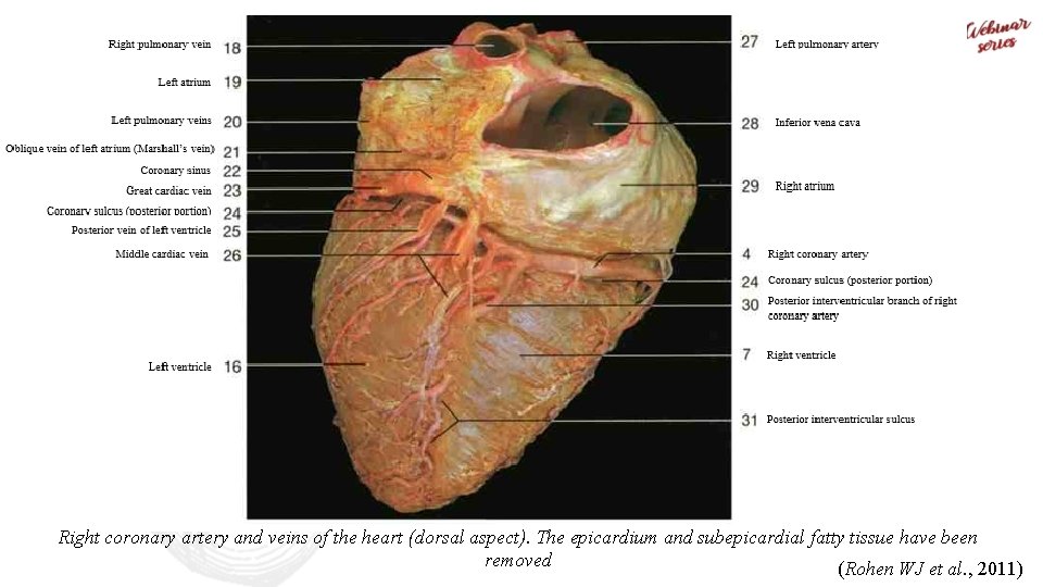 Right coronary artery and veins of the heart (dorsal aspect). The epicardium and subepicardial
