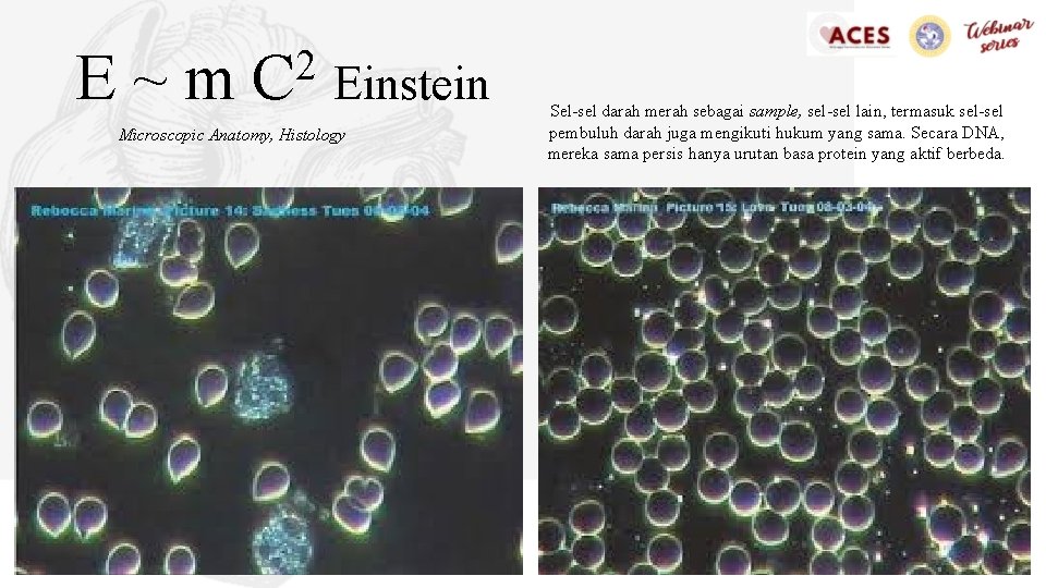 E~m 2 C Einstein Microscopic Anatomy, Histology Sel-sel darah merah sebagai sample, sel-sel lain,