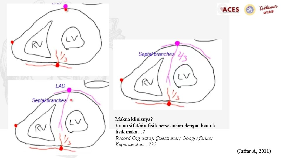 Makna klinisnya? Kalau sifat/nin fisik bersesuaian dengan bentuk fisik maka…? Record (big data); Questioner;