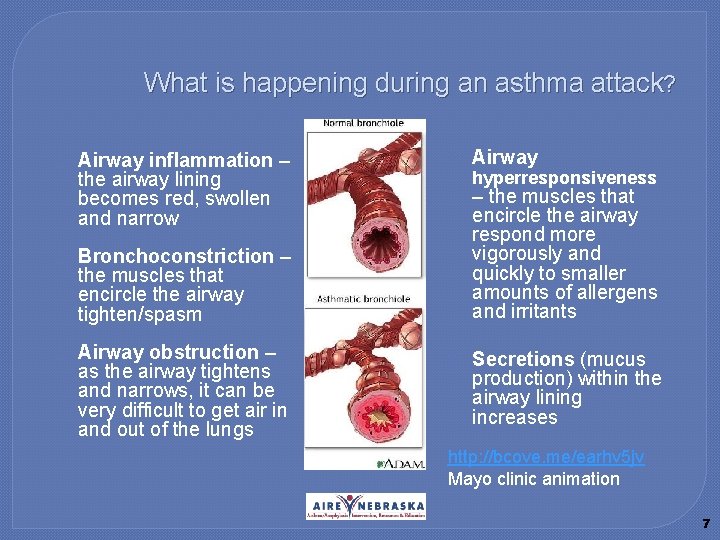 What is happening during an asthma attack? � Airway inflammation – the airway lining