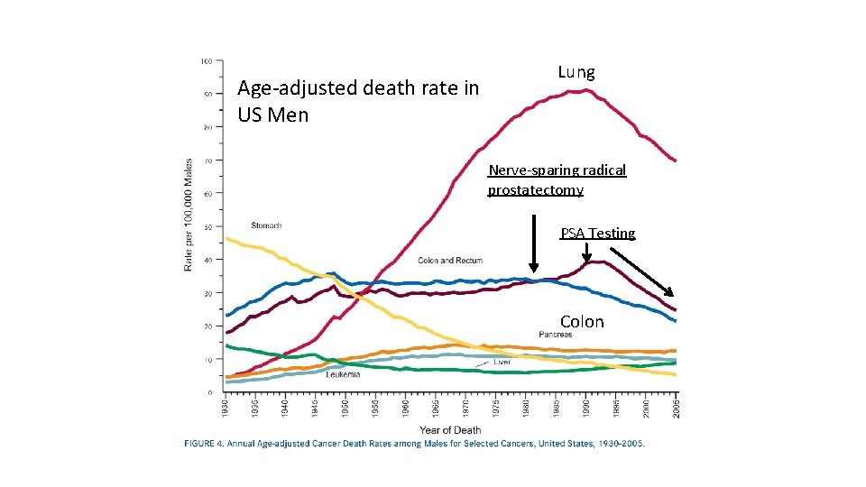 Age-adjusted death rate in US Men LL Lung Nerve-sparing radical prostatectomy PSA Testing Colon