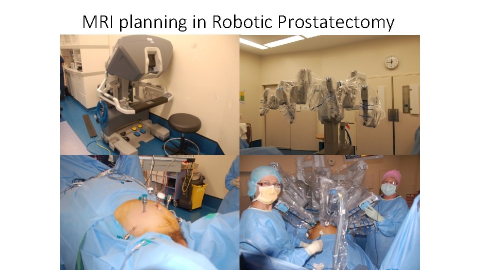 MRI planning in Robotic Prostatectomy 