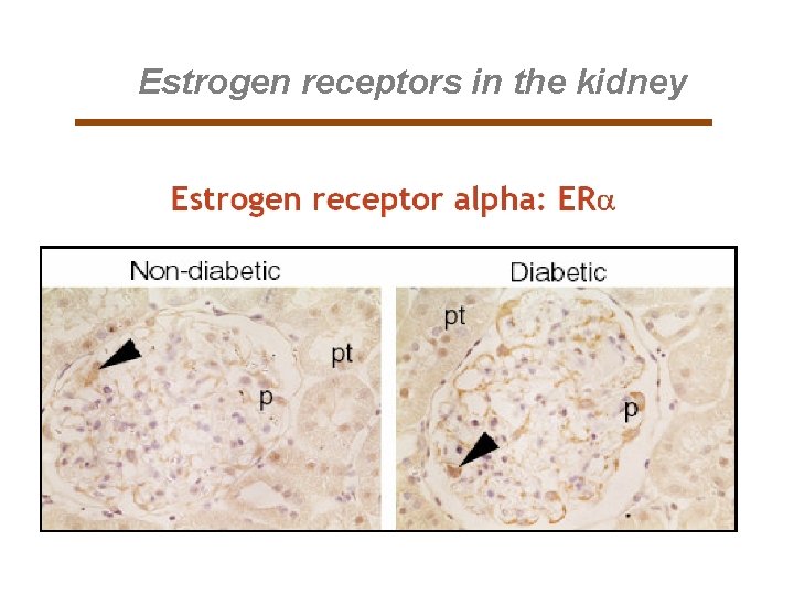 Estrogen receptors in the kidney 