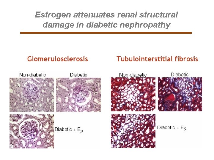 Estrogen attenuates renal structural damage in diabetic nephropathy 