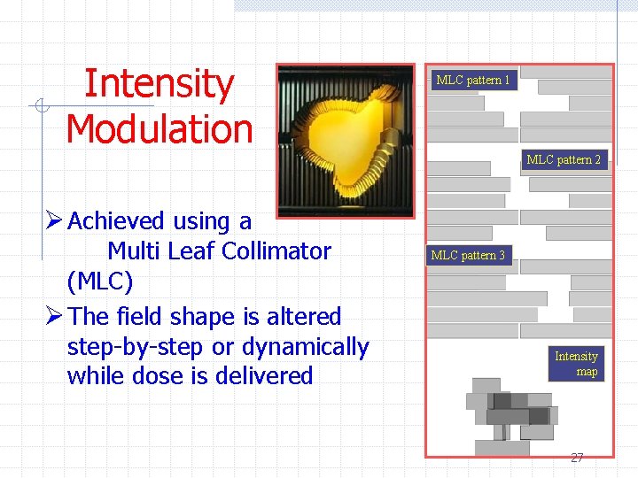 Intensity Modulation MLC pattern 1 MLC pattern 2 Ø Achieved using a Multi Leaf