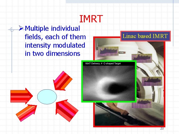 IMRT Ø Multiple individual fields, each of them intensity modulated in two dimensions Linac